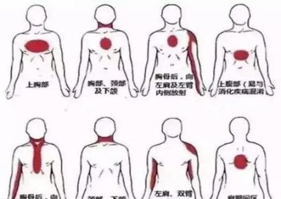 ​劳累到心脏痛怎么缓解(劳累过度心脏不舒服怎么缓解)