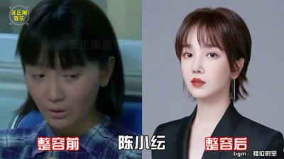​明星整容前后对比照，整形前后对比(明星整容前后的对比)