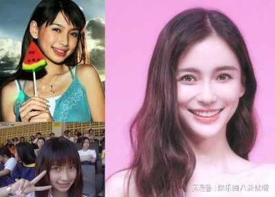 ​张子萱承认整容，张子萱医馆(张子萱长相)