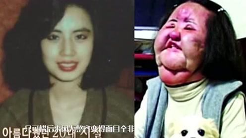郑爽整容后张翰惊呆 元