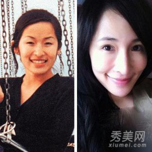 ​萧亚轩整容前后，萧亚轩和黄皓为什么分手
