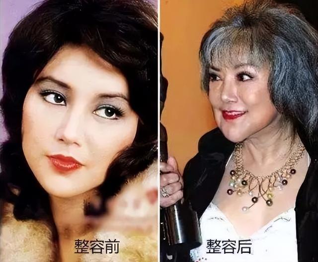整容失败图片（蛇精脸、猪鼻子、面部僵硬）