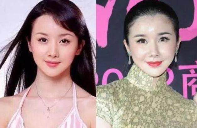 整容失败图片（蛇精脸、猪鼻子、面部僵硬）