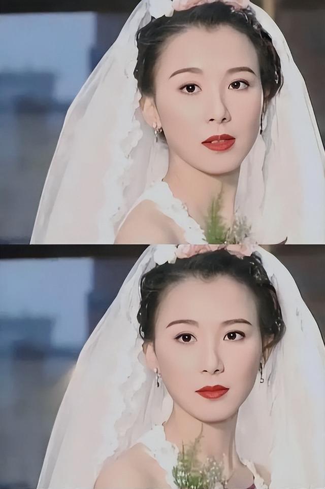 整容失败图片（蛇精脸、猪鼻子、面部僵硬）