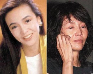 ​整容失败图片（蛇精脸、猪鼻子、面部僵硬）