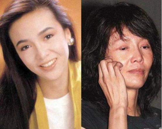 整容失败图片（蛇精脸、猪鼻子、面部僵硬）