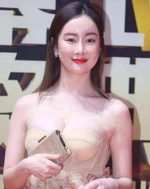 整容失败的二十位明星（那些后悔整容的7位明星太可惜）