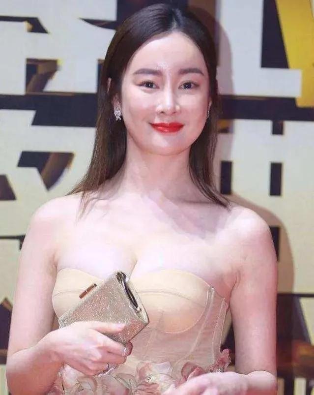 整容失败的二十位明星（那些后悔整容的7位明星太可惜）