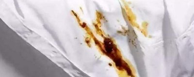 ​白衬衫火锅油渍怎么洗