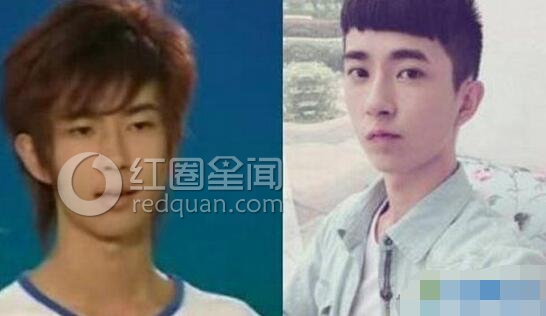 于朦胧整容前后照片 于朦胧咋出名的