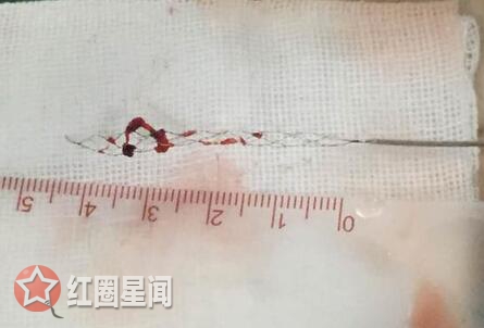 大学生打游戏3天3夜 放飞自我变成中风入院