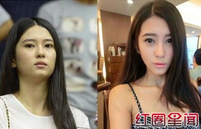 ​刘晓宇绯闻女友钟鹿纯整容对比照流出前后差距大