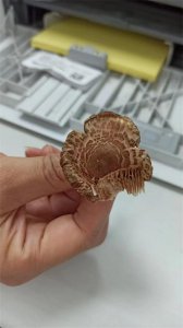 ​野蘑菇长得像香菇就能吃？大妈喝完汤后抢救了 7 天