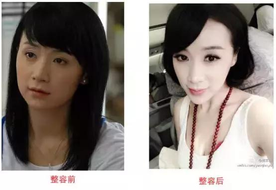杨幂跨度最大的一场戏（当红大女主削骨失败）(21)