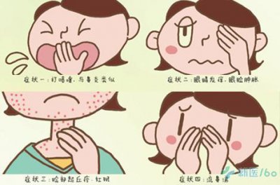 ​皮疹的症状和原因（皮疹的34个原因）