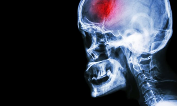 什么病排在死因第一位?最新十大死因排名