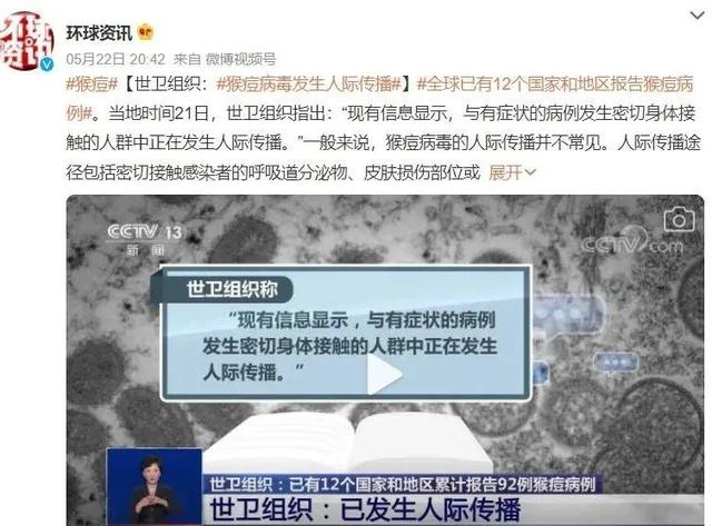 猴痘会不会大规模爆发 猴痘在多国突现(1)