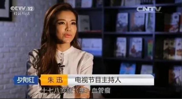 朱迅三度患癌素颜近照（美女主持朱迅17岁患血管瘤）(14)