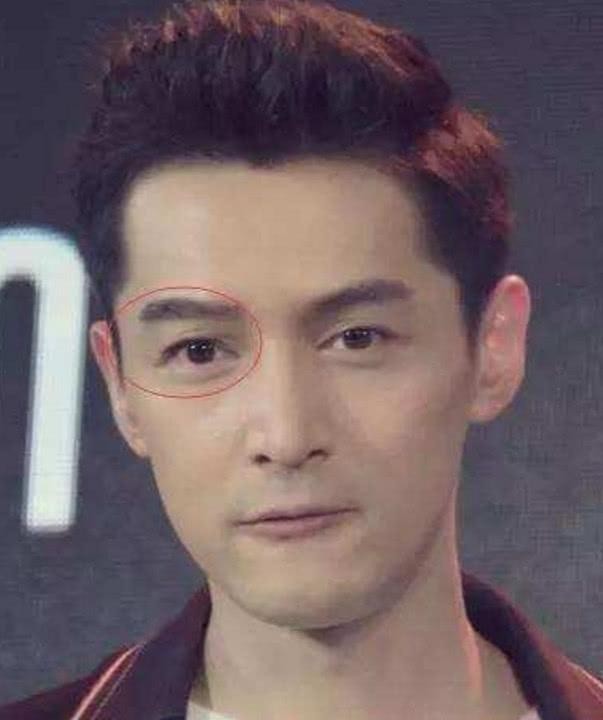 胡歌车祸前后对比（胡歌车祸毁容为什么原谅肇事司机）