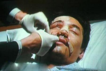 胡歌车祸前后对比（胡歌车祸毁容为什么原谅肇事司机）