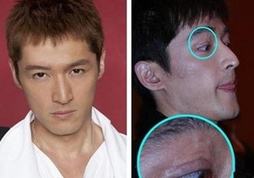 胡歌车祸前后对比（胡歌车祸毁容为什么原谅肇事司机）
