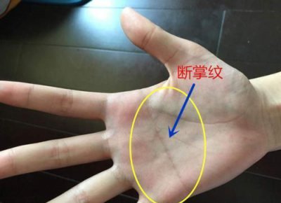 ​断掌是什么意思，断掌是什么意思？