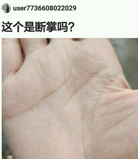 断掌是什么意思，断掌是什么意思？图3