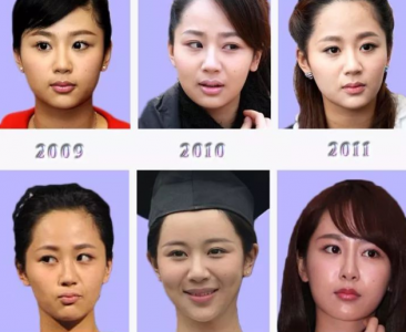 ​杨紫整容过吗？杨紫整容的原因是什么？