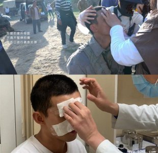 ​《我和我的父辈》花絮幕后故事 吴磊拍马战炸伤脸粉丝心疼