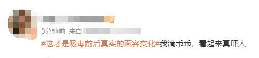 染上毒瘾后外貌的真实变化太吓人！ 感觉权志龙要变异了