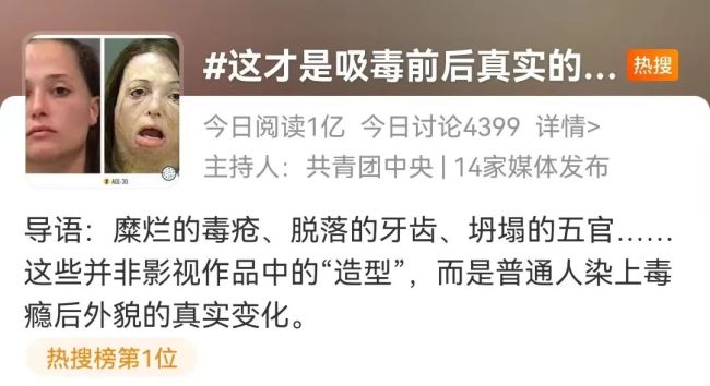 染上毒瘾后外貌的真实变化太吓人！ 感觉权志龙要变异了
