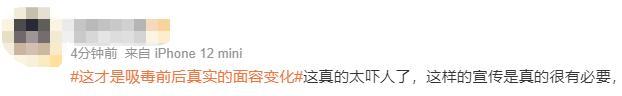 染上毒瘾后外貌的真实变化太吓人！ 感觉权志龙要变异了