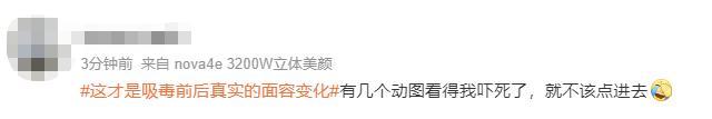 染上毒瘾后外貌的真实变化太吓人！ 感觉权志龙要变异了
