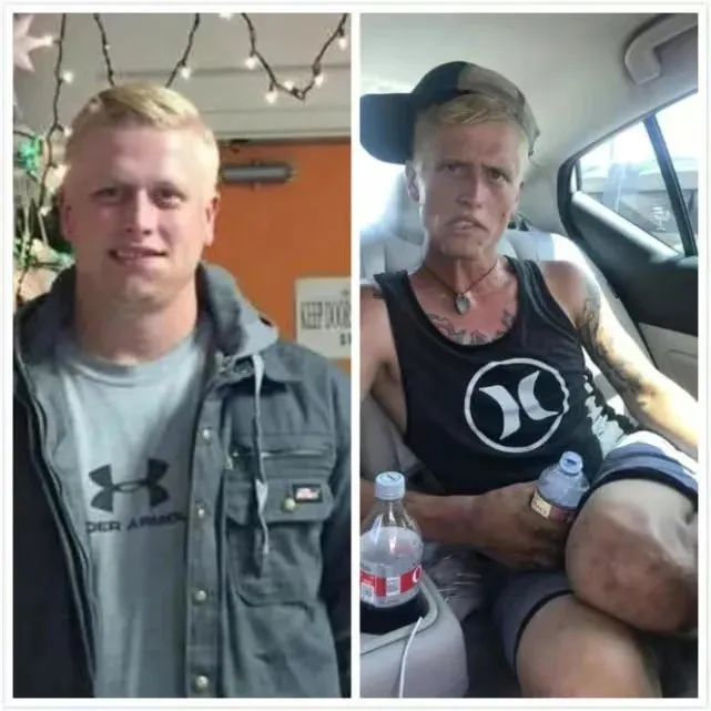 染上毒瘾后外貌的真实变化太吓人！ 感觉权志龙要变异了