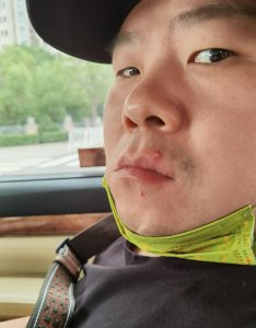 ​郑敏晒岳云鹏怼脸照，调侃老公长青春痘，小岳岳胡子拉碴一脸冷漠