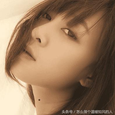 脖子上有三颗痣连着的好吗（脖子上的痣能不能点）