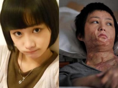​周岩：曾拒绝同学求爱，被泼汽油毁容，11年过去了她过得还好吗？