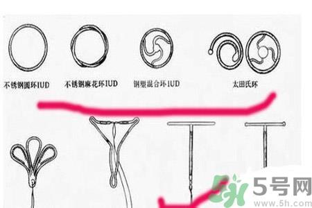 什么是宫内节育器？放置宫内节育器为什么能避孕？