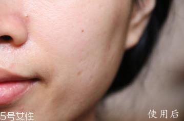悦木之源和伊丽莎白雅顿哪个好？两款精华大比拼