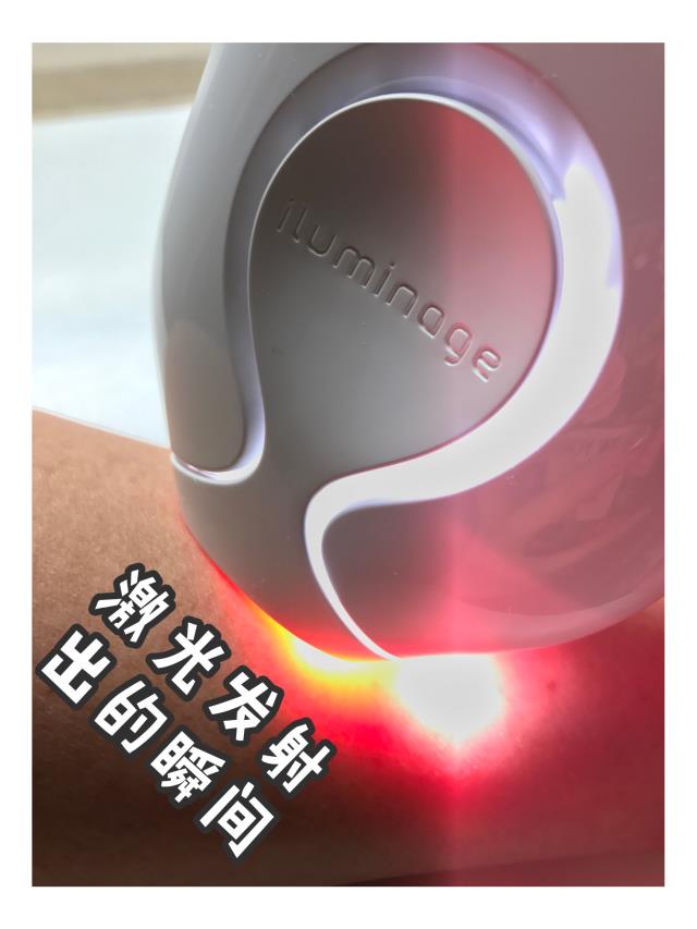 iluminage touch脱毛仪扒皮 iluminage touch脱毛仪