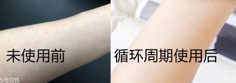 飞利浦脱毛仪不适合什么人使用 飞利浦脱毛仪不宜人群