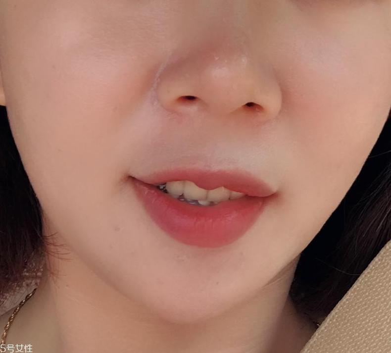 赛贝格精华使用方法 修复抗老一步到位