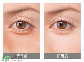 卡琳朵贵妇蛇毒眼膜贴怎么用?使用方法