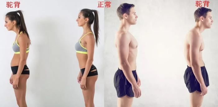 驼背、圆肩、含胸=又老又丑！穿它3秒矫正，气质翻倍~