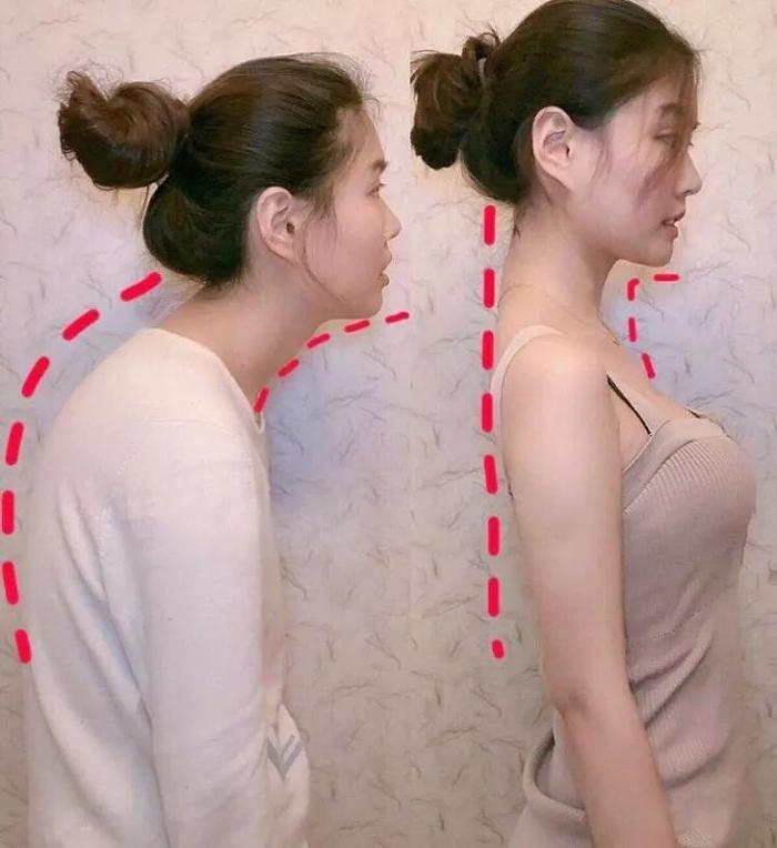 驼背、圆肩、含胸=又老又丑！穿它3秒矫正，气质翻倍~