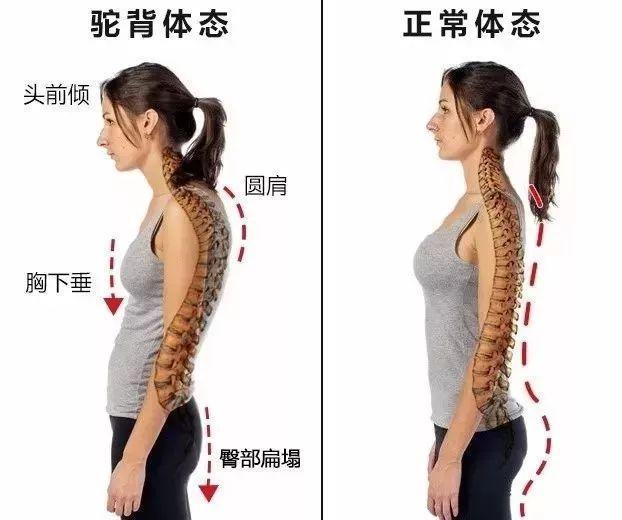 驼背、圆肩、含胸=又老又丑！穿它3秒矫正，气质翻倍~