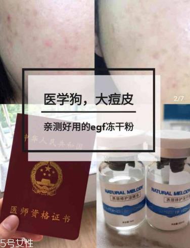 冻干粉使用多久有效果 每个人的使用情况不一样
