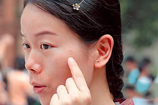 痘痘贴有危害吗 什么样的痘痘适合痘痘贴