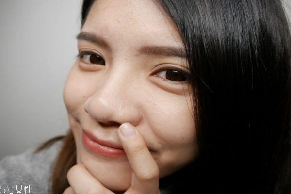 什么样的痘痘才适合用痘痘贴 痘痘贴的注意事项