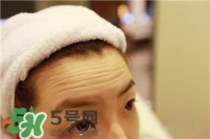 抬头纹是什么?抬头纹是怎么产生的?